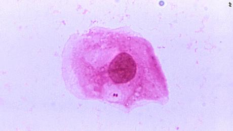 Neisseria meningitidis is a contagious bacterial infection.