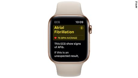 The app can test for atrial fibrillation, a potentially serious heart condition.