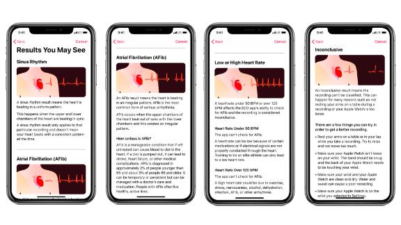 Apple Ecg App How Accurate Is It Cnn