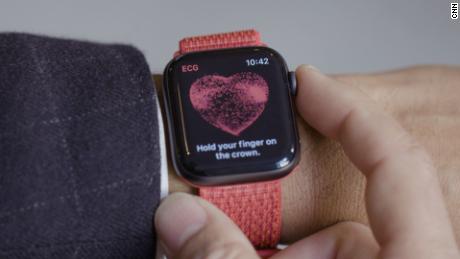 Apple Watch app could detect life-threatening irregular heartbeat, study says