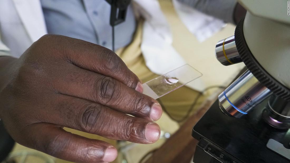A lab technician at Kiruddu General Hospital in Uganda&#39;s capital Kampala examines a microscope slide for malaria.