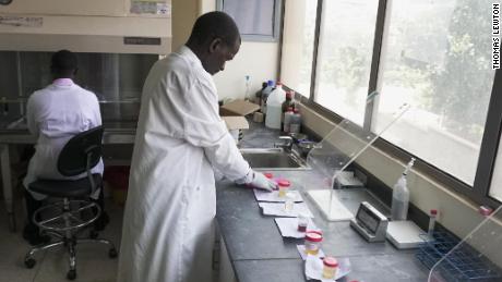 A technician at the diagnostics lab at Kiruddu General Hospital. 