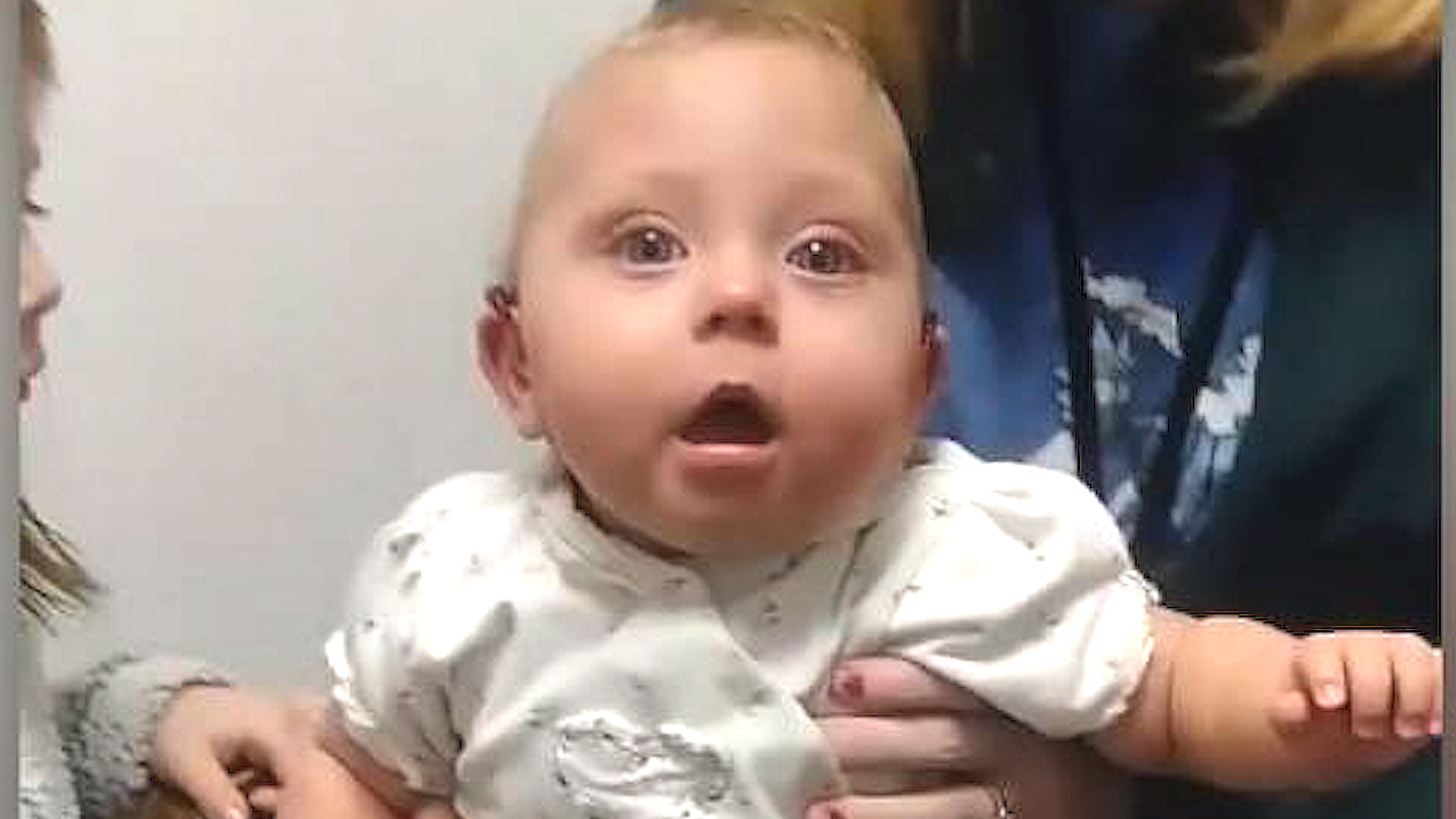 first gerber baby with down syndrome