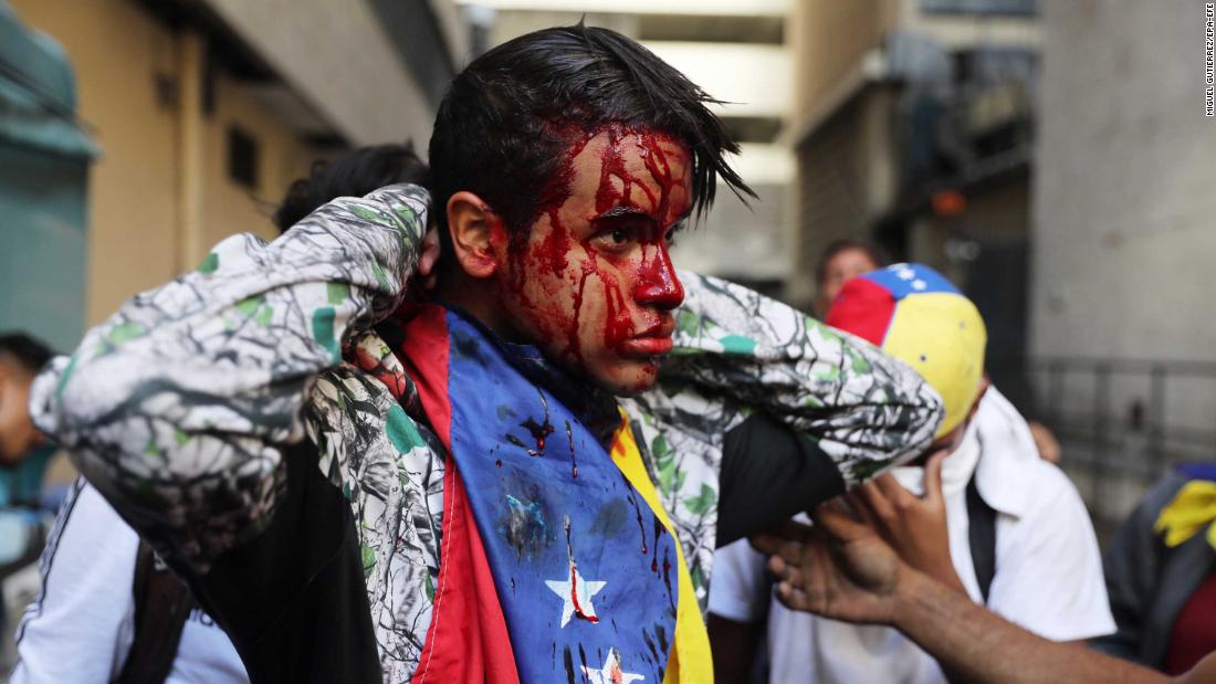 A wounded protester in Caracas on January 23.