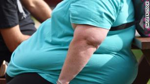 Half of America will be obese within 10 years, study says, unless we work together