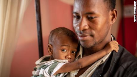 Jean Claude Nambinintsoa traveled for 24 hours in a mini-bus taxi to get his 15-month-old, Pierrot, to the hospital.