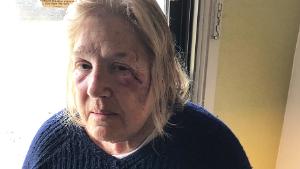 A woman suffered cuts and bruises after her Sausalito, California home slid off its foundation early Thursday and down the hill and crashed into another home, according to Southern Marin Fire Protection District. Susan Gordon, 76, was treated and released from a hospital, her children said.