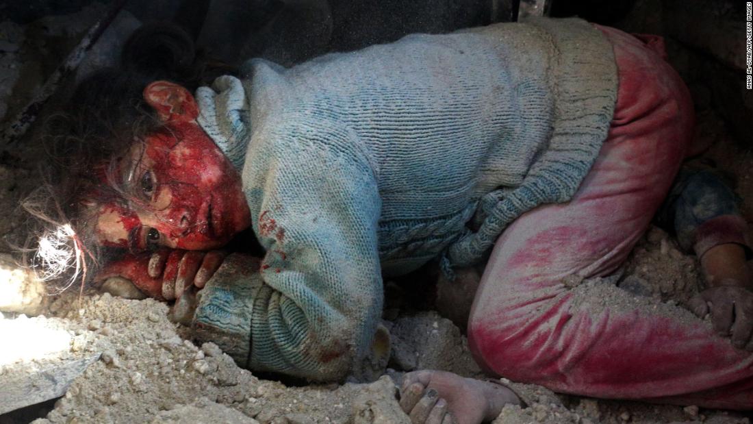 A wounded girl waits to be rescued after an airstrike in Khan Sheikhoun, Syria, on Tuesday, February 26.