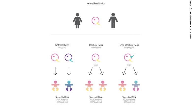 Semi-identical Twins Are Rare, And Doctors Say They've Identified The ...