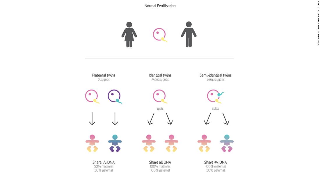 case study of the czech twins