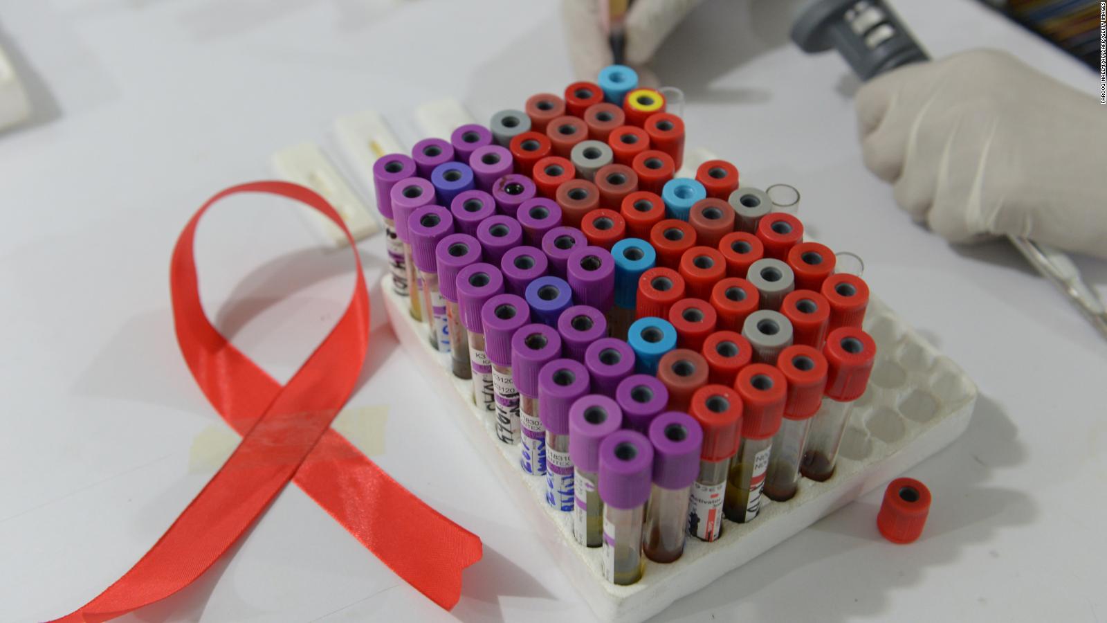 hiv research