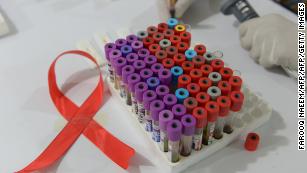 HIV/AIDS Fast Facts