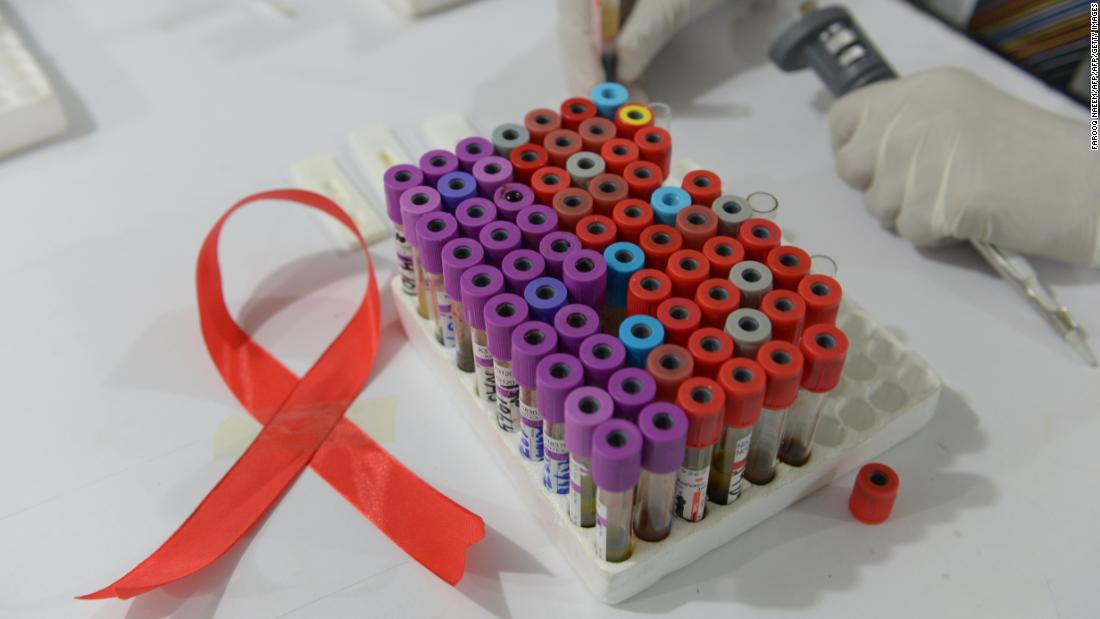 On World AIDS Day, these three big challenges stand in the way of HIV/AIDS research - CNN thumbnail