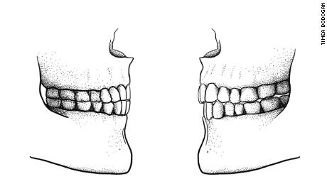 Human speech sounds evolved because of our diet, study says