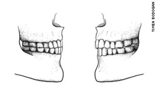 Neanderthal genes could explain the shape of our skulls, study finds