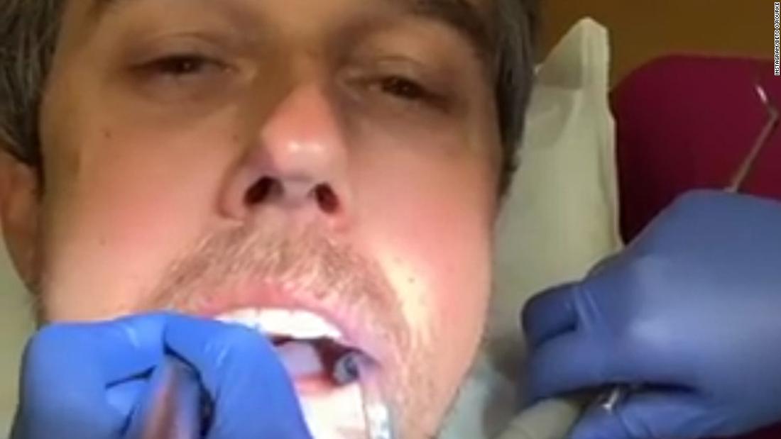 While at the dentist in January 2019, O&#39;Rourke &lt;a href=&quot;https://www.cnn.com/2019/01/10/politics/beto-orourke-dentist-instagram/index.html&quot; target=&quot;_blank&quot;&gt;posted video to Instagram.&lt;/a&gt; &quot;We&#39;re going to continue our series on the people of the border,&quot; he said, introducing his dental hygienist Diana and saying she was &quot;going to tell us a little bit about growing up in El Paso.&quot; Diana explained that her mother was from Mexico and her father was from the United States. She said she was born in El Paso and that her neighborhood helped her mother study to become a US citizen.