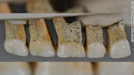 Right Upper teeth of the individual CCH6, the type specimen of the new species Homo luzonensis. From left to right: two premolars and 3 molars, in lingual view.

Credit: Callao Cave Archaeology Project . Email address for the copyright holder: florent.detroit@mnhn.fr