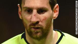 Lionel Messi pictured bruised and bloodied in Barcelona's Champions League quarterfinal match against Manchester United.