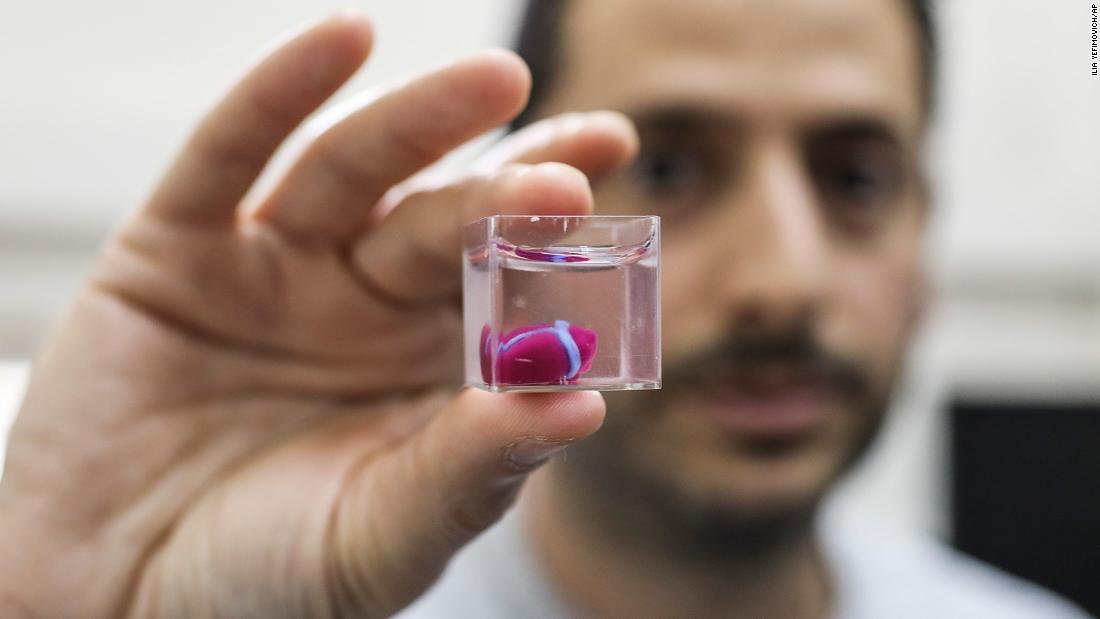 3D-print heart from patient's cells CNN