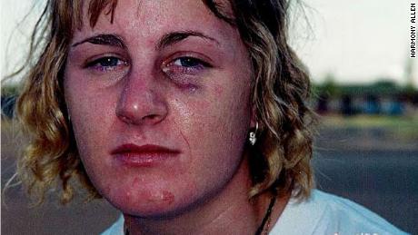 Harmony Allen one week after her rape on September 4, 2000, on Sheppard Air Force Base in Texas. She had previously worn makeup to hide her injuries; for this photo, she was asked to wash her face.