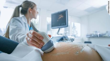 Medicaid expansion tied to fewer maternal deaths, study says