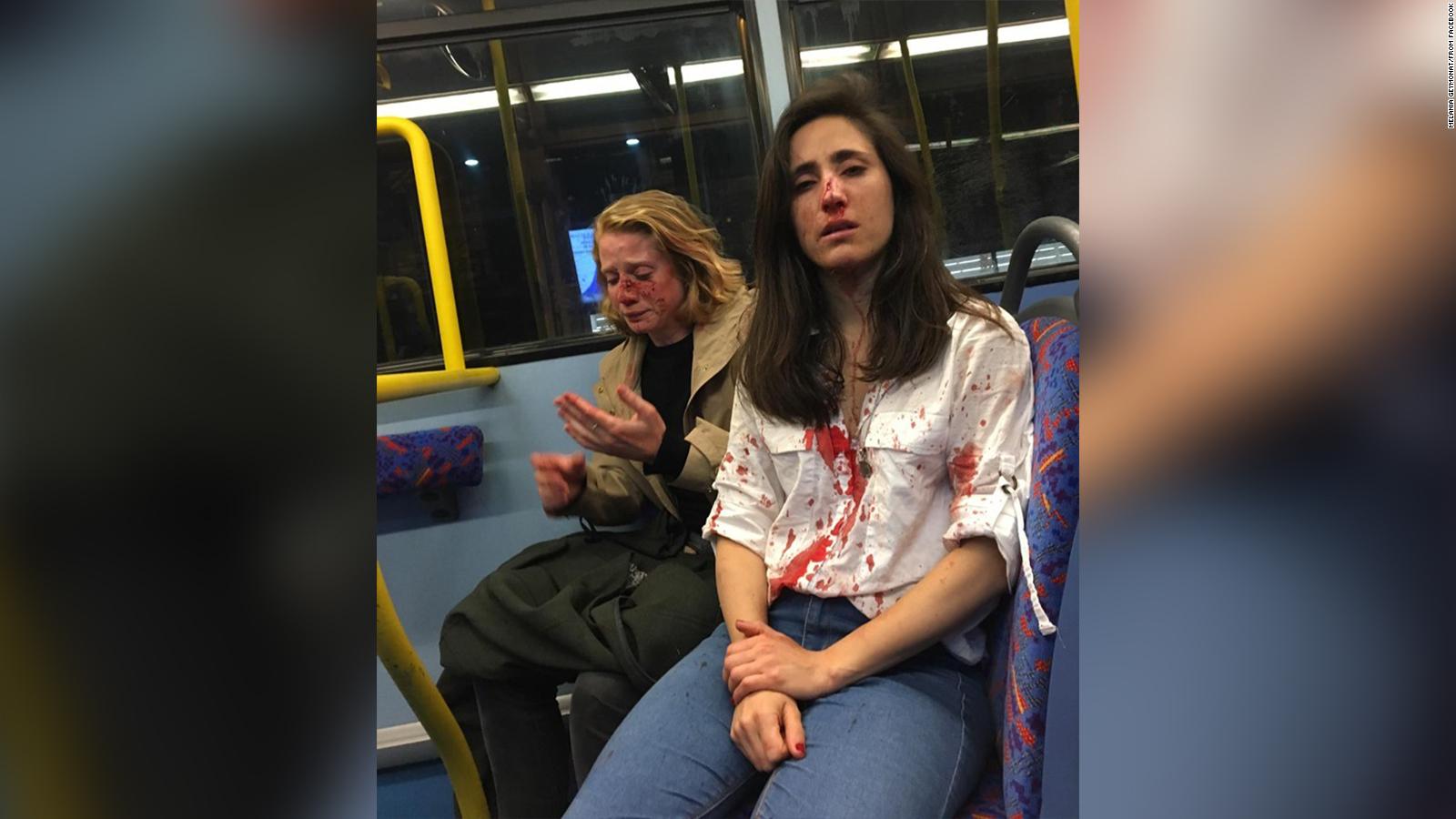 Police Lesbian Couple Attacked On London Bus Cnn Video