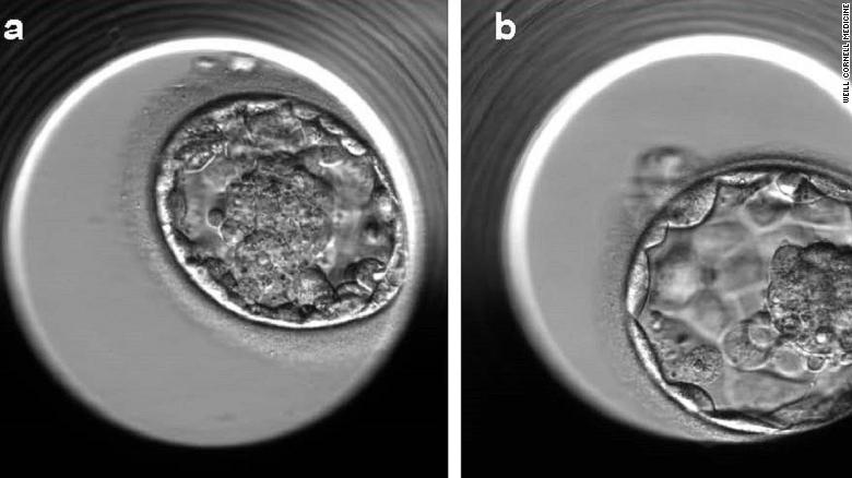 This technology could help improve the success rate of IVF