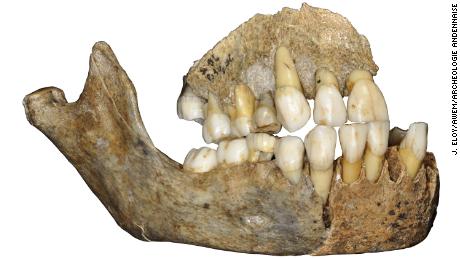 Bones uncover mysterious early history of the Neanderthals