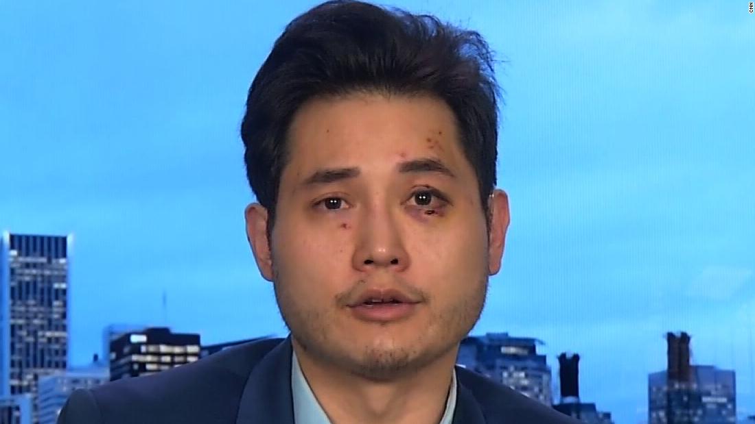 Conservative Journalist Andy Ngo Says Antifa Attacked Him In Portland 