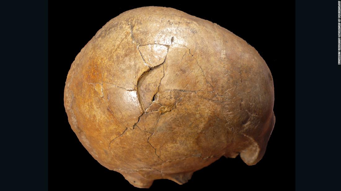 A 33,000-year-old human skull shows evidence of being struck with a club-like object. The right side of the man&#39;s head has a large depressed fracture.