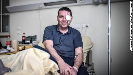 David Breidenstein says one of his great regrets is that his eye injury has kept him from protesting. He will be back on the streets on Bastille Day.