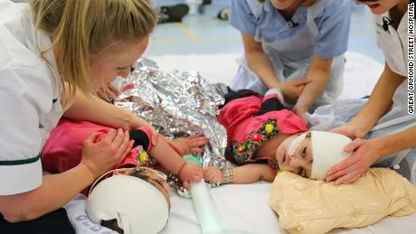 Conjoined twins Safa and Marwa are recovering well after complex surgery at London&#39;s Great Ormond Street Hospital.