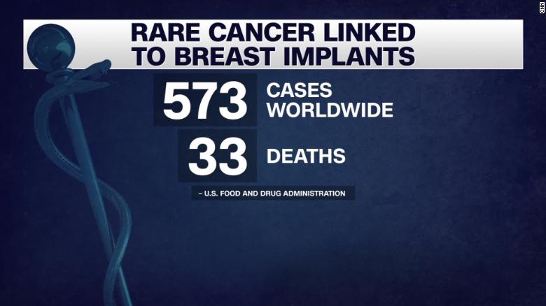 Some breast implants recalled following cancer link