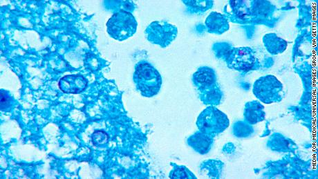 Brain-eating amoeba kills man who went swimming at North Carolina water park