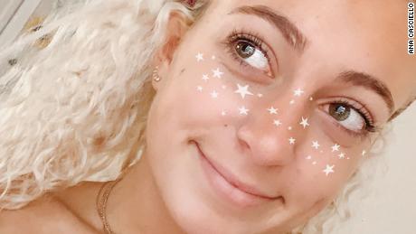 Casciello using her filter that gives users freckles in the shape of stars.