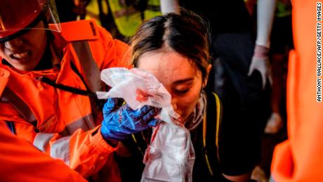 Medics look after a woman who received a facial injury during a standoff between protesters and police in Tsim Sha Tsui in Hong Kong on August 11, 2019.