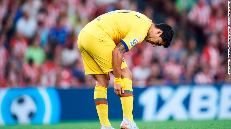 It&#39;s unclear how long Suarez will be out with a calf injury.