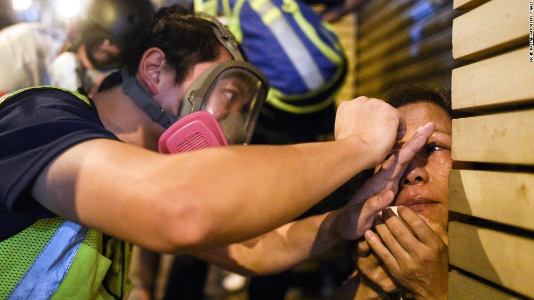 A woman is treated after police fired tear gas to disperse protesters in the Mong Kok district of Hong Kong on October 7.