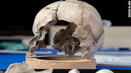 Kimmerle has reconstructed the skull and sent samples off for DNA testing. 