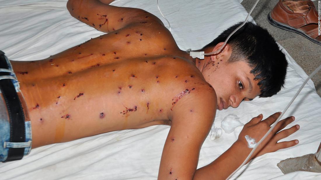 A demonstrator receives medical treatment in a hospital in Bangladesh.