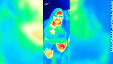 Heat camera at tourist attraction spots woman&#39;s breast cancer
