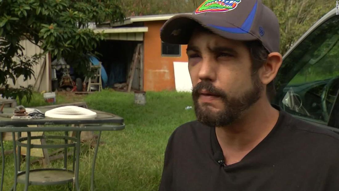 A Florida Man Says His Pregnant Wife Saved His Life In Home Invasion