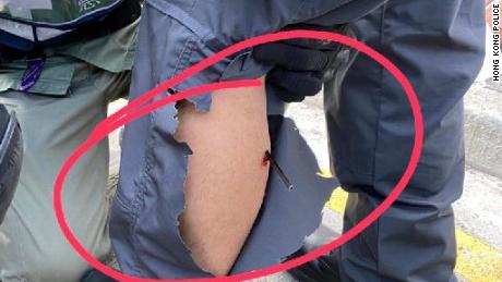 A handout image from the Hong Kong Police shows an arrow in the calf of a Hong Kong police officer on Sunday, Nov. 17, 2019.