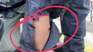 A handout image from the Hong Kong Police shows an arrow in the calf of a Hong Kong police officer on Sunday, Nov. 17, 2019.