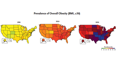 Us Obesity Rate Half Of America Will Be Obese Within 10 Years Study Says Unless We Work Together Cnn