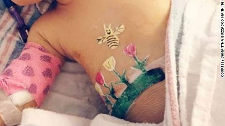 &quot;We had no idea ahead of time that this was Dr. Parry&#39;s special trademark. He told us he did it because her name was Rose and thought it would be fitting. We were really moved by it,&quot; Samantha Manning told CNN.