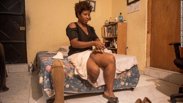 Professor Nirva Saint-Louis, who was injured in the earthquake, puts on a prosthesis at her home in Port-au-Prince in January 2020. Ten years after the earthquake, many Haitians continue to live with the weight of physical and psychological trauma. 