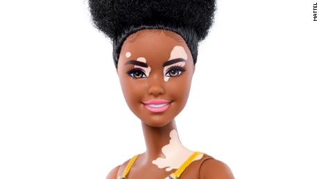 New Barbie dolls feature vitiligo and hairless models - CNN Style