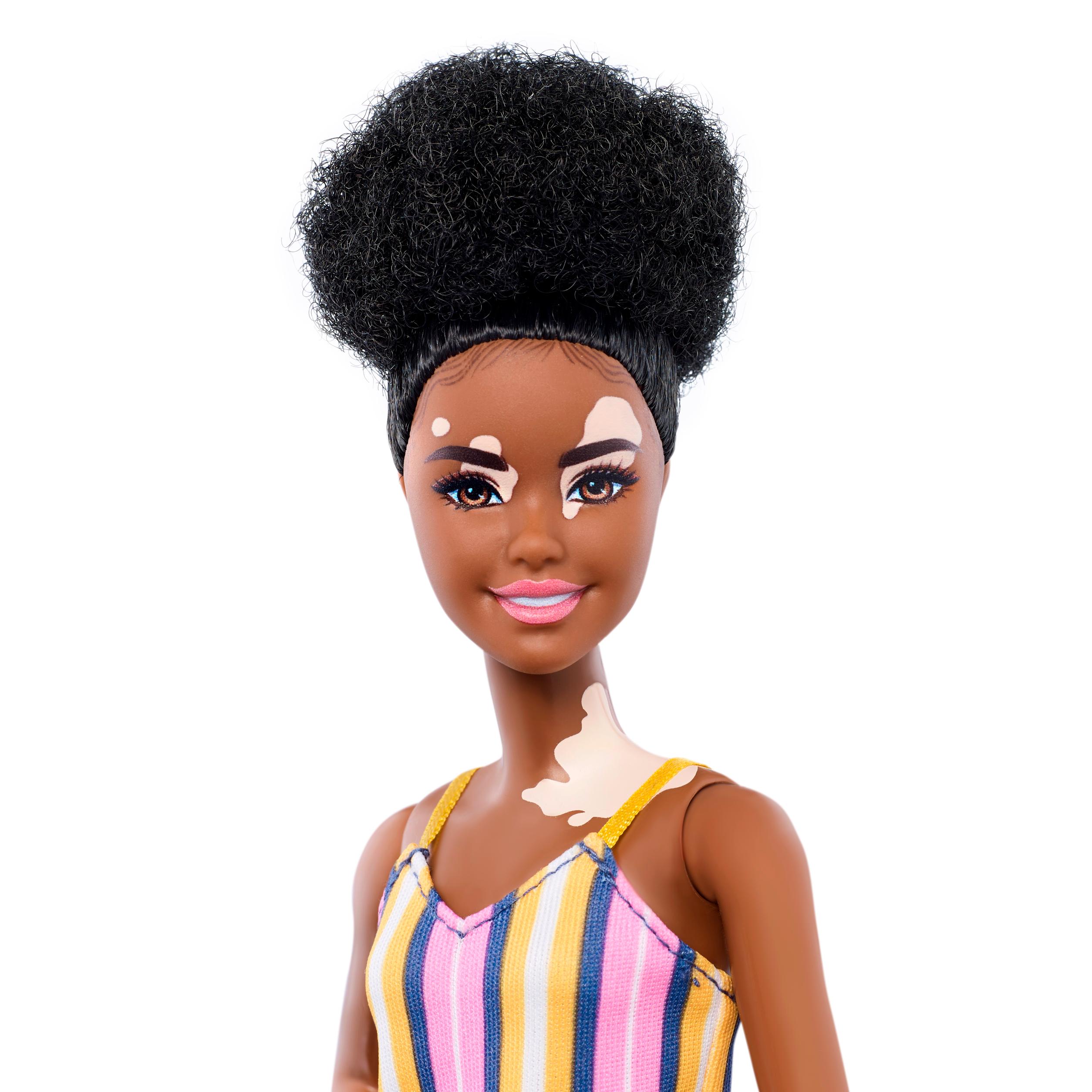 New Barbie dolls feature vitiligo and hairless models - CNN Style