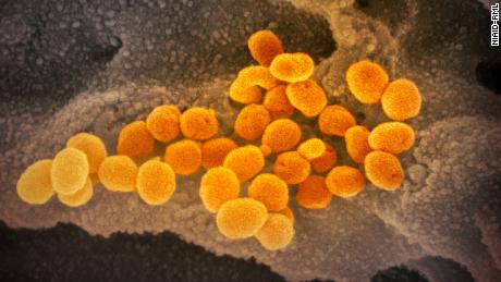 This scanning electron microscope image shows SARS-CoV-2 (orange)—also known as 2019-nCoV, the virus that causes COVID-19—isolated from a patient in the U.S., emerging from the surface of cells (gray) cultured in the lab. Credit: NIAID-RML